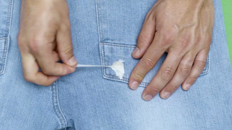 KnipTIP | Kauwgom uit kleding verwijderen